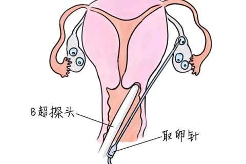 http://taiyuan.vdtfzz.com/post/205.html|太原供卵助孕