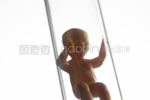 http://taiyuan.vdtfzz.com/post/197.html|太原试管助孕